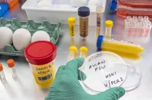 Scientific sampling of eggs in poor condition, analysis of avian influenza in humans, conceptual image